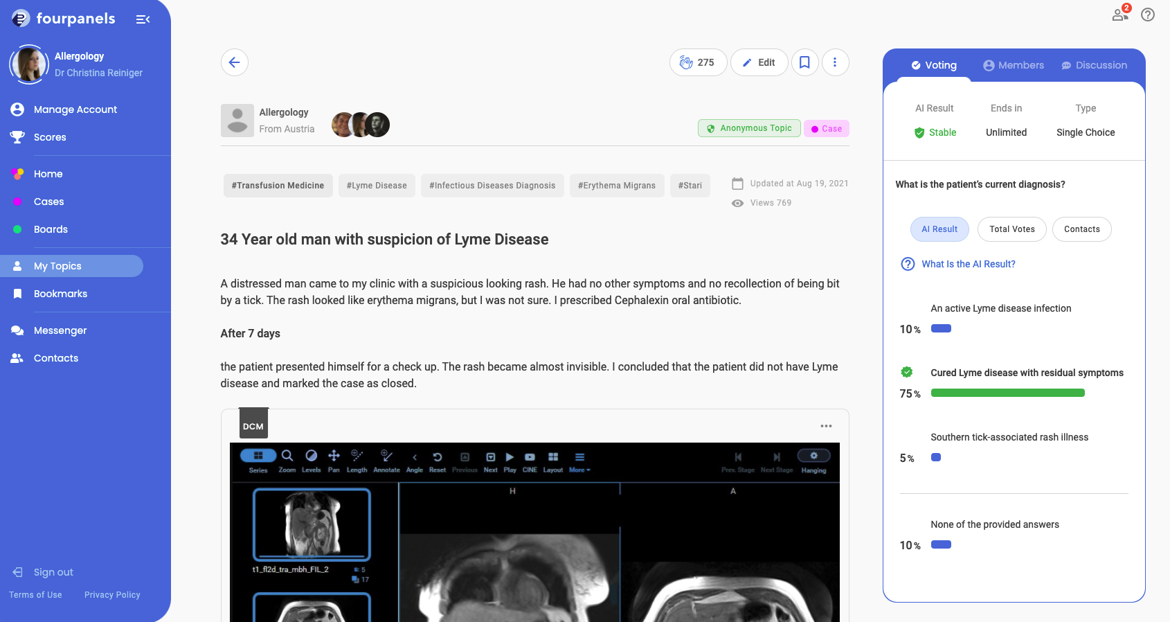 AI-supported help in optimal patient care