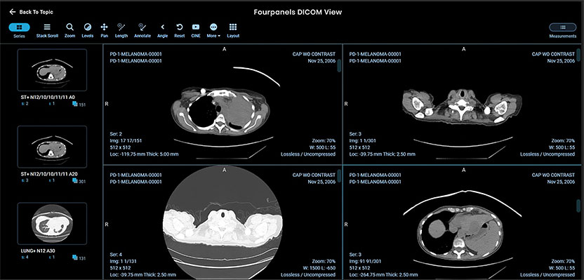 Dicom-Viewer